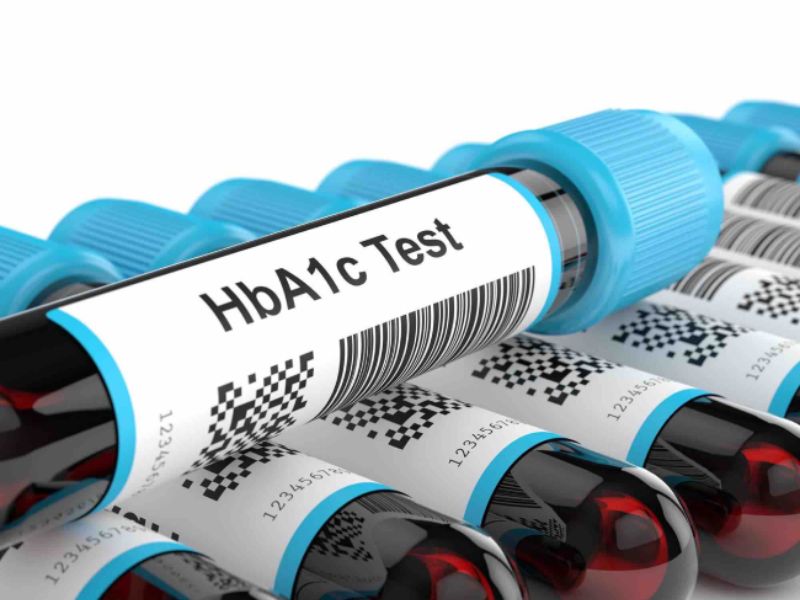 Quy trình và yếu tố ảnh hưởng đến xét nghiệm HbA1c