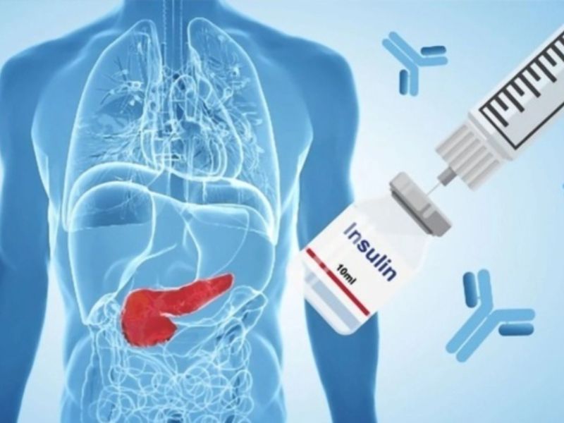 Bệnh đái tháo đường, hay tiểu đường không phụ thuộc insulin là gì?